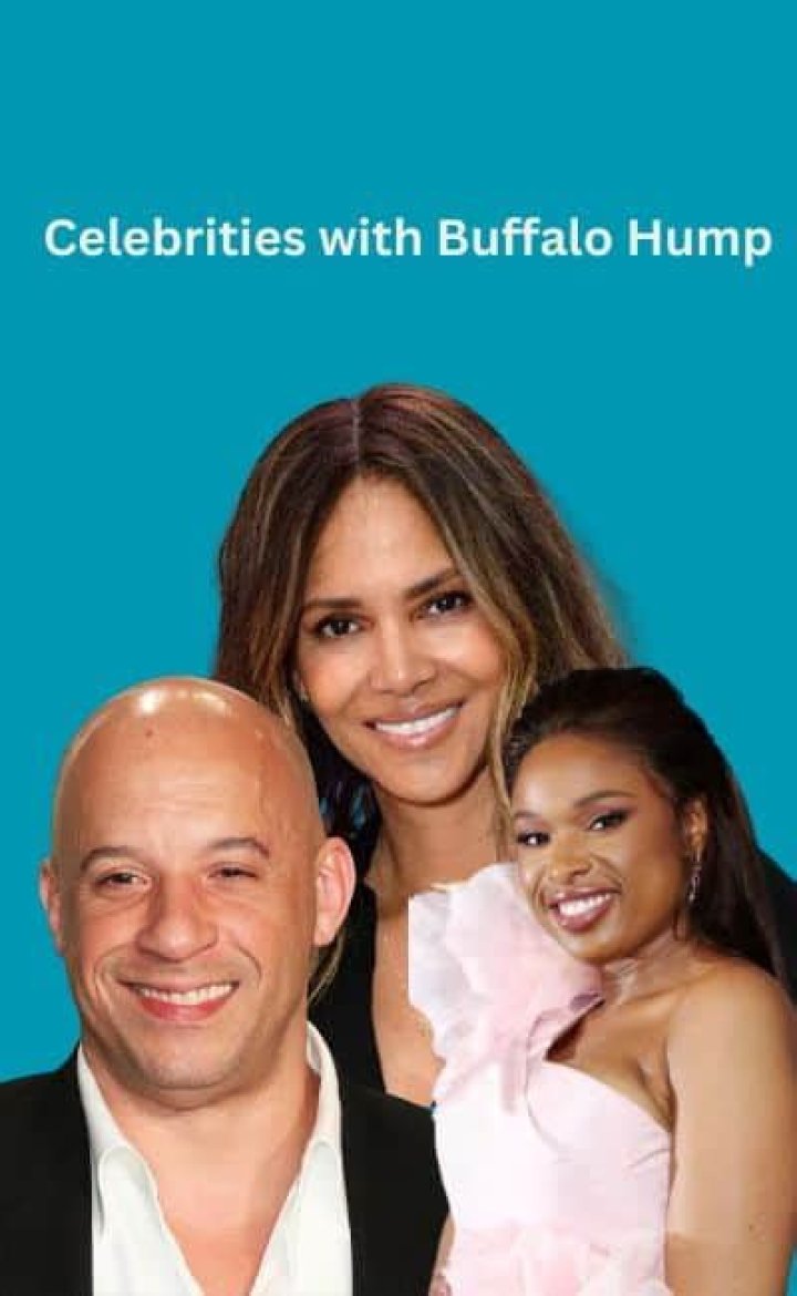 20 Celebrities Who Have Buffalo Hump