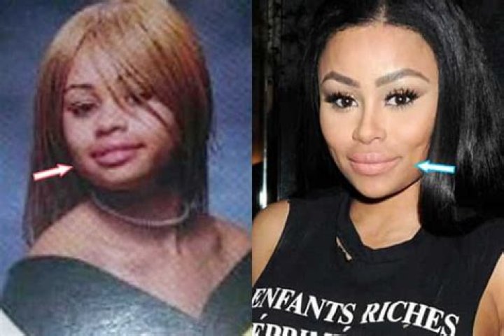 Blac Chyna Causing a Lip Stir and Other Surprises you Don’t Know