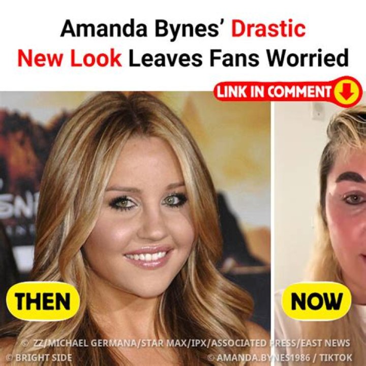 Fans Can’t Wait to See Amanda Bynes Back on Her Feet