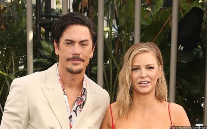 Fans Spot Black Eye On Tom Sandoval After He Alleged Ariana Madix 'Punched' Him