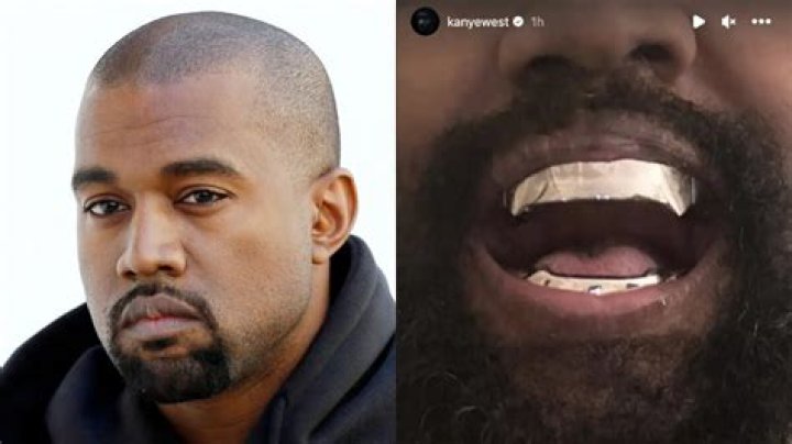 Kanye West 'fools the internet' with villain-inspired 'teeth' costing almost $1 million